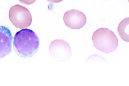 4194 Blood cancer header_zc_v2_no frame