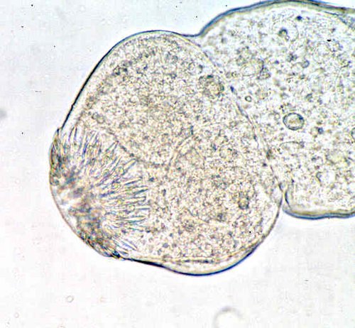 Echinococcus protoscolex